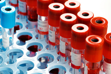 Blood sample tubes  medical equipment close up