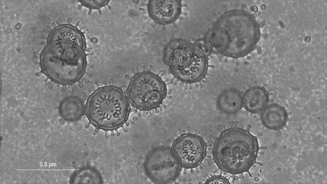 The coronavirus is shot with a high zoom through an electron microscope. 2019-nCOV or COVID-2019 3d rendered TV concept