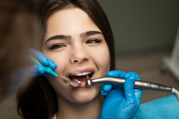 dentist in blue gloves filling the beautiful smiling woman patient's root canal using mirror under...