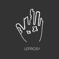 Leprosy chalk white icon on black background. Dangerous bacterial disease, contagious illness. Nerve damaging sickness. Disfigured human hand isolated vector chalkboard illustration