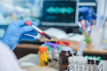 HIV VDRL label Blood test tube in Medical Scientist hand in Laboratory room at hospital, blood test tube for analysis for diagnosis illness results