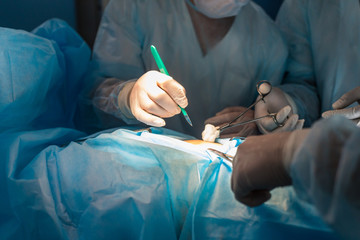 Close-ups of doctor's hands in medical gloves during surgery