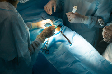 An international team of doctors performs a complex surgical operation on a patient under anesthesia. Modern operating room and experienced surgeons save lives