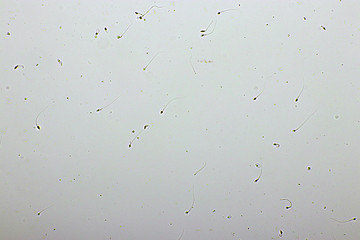 Sperm cells or spermatozoa in semen, analyze by microscope, 400x