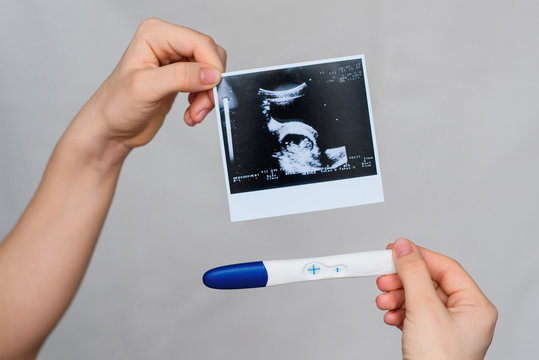 Urine Analysis Pregnancy Test Positive Stock Photo 1140494648