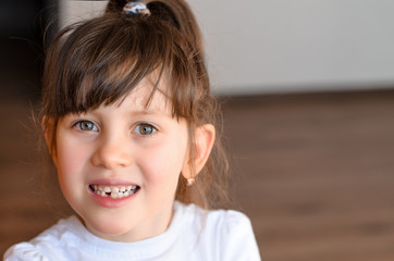 Cute preschooler showing her milk tooth fell out and her growing permanent tooth in open mouth....