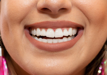 Laughing woman mouth with great teeth. Healthy beautiful female smile. Teeth health, whitening, prosthetics and care.