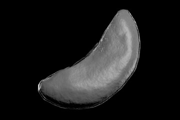 Sickle Cell Anemia 3D Illustration