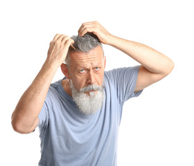 Senior man with hair loss problem on white background