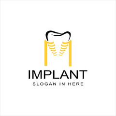 dental implant logo vector icon illustration