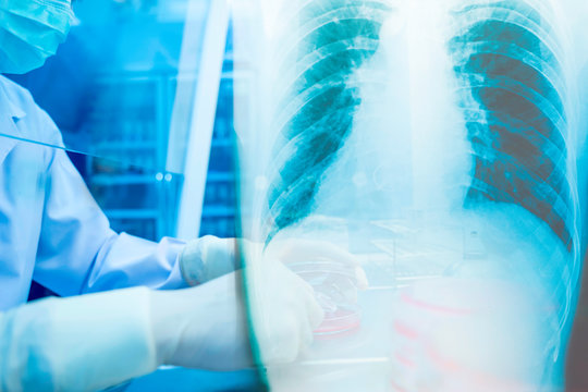 Lung x-ray film and mask Double exposure, uniformed male doctor,Coronavirus(COVID-19) - 2019-nCoV Wuhan Virus Concept.research for vaccine production.