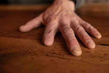 The amputated hand of a carpenter