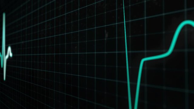 Heartbeat line, graph of heart rhythm on medical screen with grid. ECG, EKG, electrocardiogram heartthrob, cyan line with white core in close-up. Seamlessly loop animation