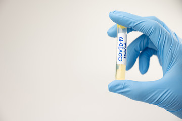Doctor, nurse or scientist hand holding coronavirus lab tube, covid-19 vaccine