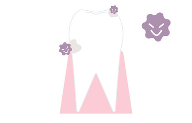 虫歯の初期段階、表面が白濁化