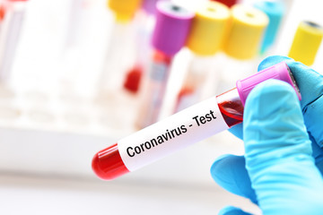 Test tube with blood sample for coronavirus test