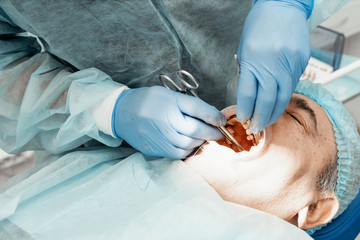 Patient and dentist during implant placement operation. Real operation. Tooth extraction, implants. Professional uniform and equipment of a dentist. Healthcare Equipping a doctor’s workplace. 