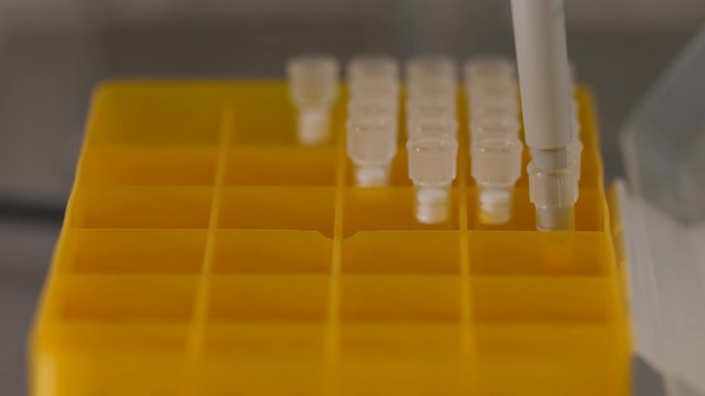 Close-up of laboratory tools, embryologist taking plastic nozzle on pipette out from box during work in perinatal clinic. Specialist working on microbiological research in reproductive medicine