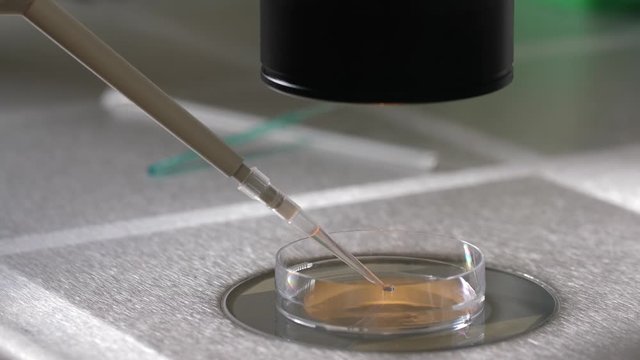 Procedure for placing cryoprotectant in petri dish standing under microscope on laboratory table. Laboratory manipulation of embryologist during preparation for cryopreservation of embryos