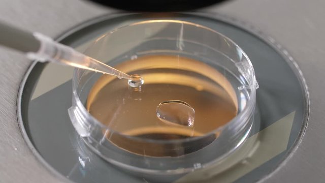 Close-up of laboratory manipulation, microbiologist placing drop of cryoprotectant under microscope during preparation for cryopreservation. Laboratory assistant working with pipette and petri dish