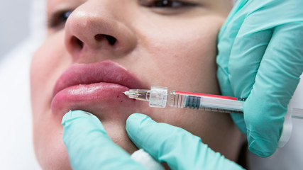 The young beautician doctor preparing to making injection in female lips. The doctor cosmetologist...