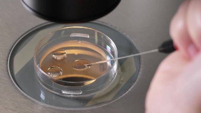 Hand of embryologist with pipette during procedure for placing embryo in cryoprotectant. Petri dish with drops of cryoprotectant standing under microscope while specialist placing embryo in substance