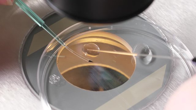 Close-up of filigree laboratory manipulation, moving of embryo from cryoprotectant to special medical tool for subsequent freezing. Specialist using pipette to take embryo and place in liquid nitrogen