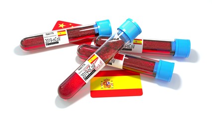 Kingdom of Spain national flag 3D wuhan 2019-ncov virus bio test tube. 3D illustration