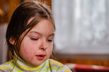 Sad girl child with hurt and scratches on the face from bump, insurance concept or pain concept.