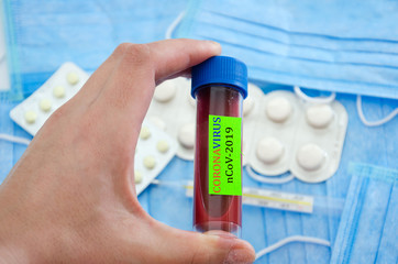 Positive blood test result for the new rapidly spreading Coronavirus, originating in Wuhan, China