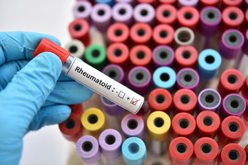 Obraz premium Blood sample tube positive with COVID-19 or novel coronavirus 2019 found in Wuhan, China