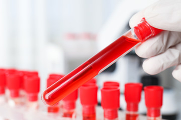 Scientist holding test tube with blood sample in laboratory, closeup. Virus research