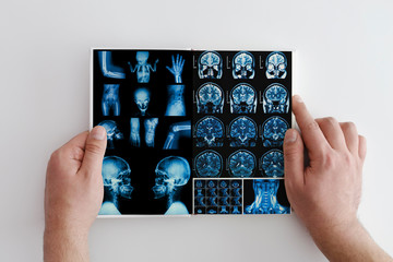 Hands hold MRI scan of head, neck and brain of patient, holding in hands. Concept photo of...