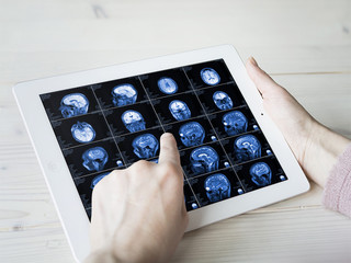 Hands hold MRI scan of head, neck and brain of patient, holding in hands. Concept photo of...