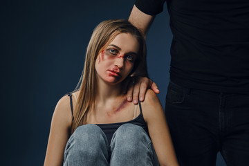 Fototapeta premium Strong man put his hand on female shoulder. Scared victim with bruises on face sitting nearby. Blue background. Domestic violence, abuse. Close-up.
