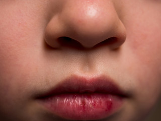 Beautiful nose and lips of ten year old child close up, 10 y.o. kid