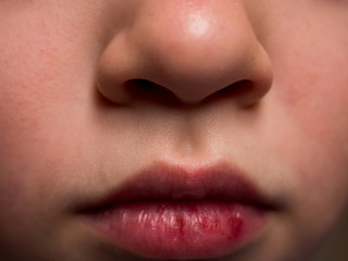 Obraz premium Beautiful nose and lips of ten year old child close up, 10 y.o. kid