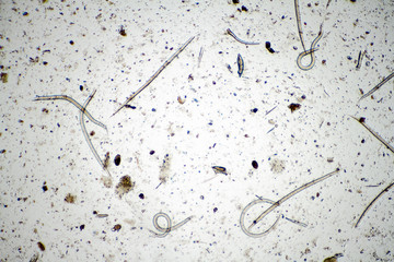 Microscope view of hookworms (Ancylostoma cninum).
