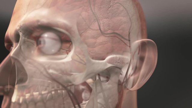 Hemorrhagic stroke. 3D animation of hemorrhage and brain damage
