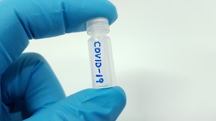 Coronavirus sample 