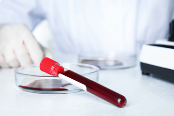 Scientist working in laboratory, focus on test tube and Petri dish with blood samples. Virus...