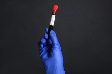 Scientist holding test tube with blood sample and label CORONA VIRUS on black background, closeup