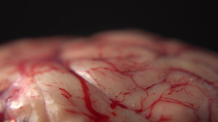 Prop for surgeons education and real example of brain tissue for training to perform brain surgery on central nervous system at hospital.