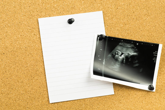 blank note on a cork card board with an ultrasound photo of baby fetus - announcing pregnancy message on paper