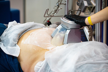 Clinic vacuum massage procedure. Hardware cosmetology. Removing fat from a woman’s body. Close up.