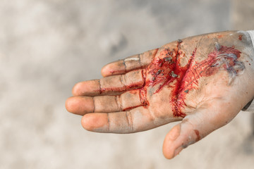 a young boy hand is cut off with a knife and the hand is bleeding