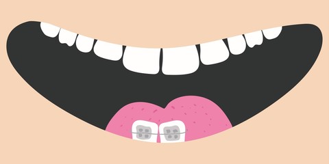 Cute cartoon smiling face. Mouth with tooth, braces and tongue. Healthy teeth brace. Body part. Oral dental hygiene Children teeth care icon. Flat design isolated on beige color background.