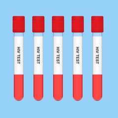 HIV Test Result with Vacutainer Contain Lab Diagnose Sexual Transmission