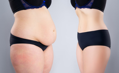 Woman's belly before and after weight loss on gray background