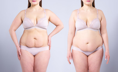 Woman's body before and after weight loss on gray background